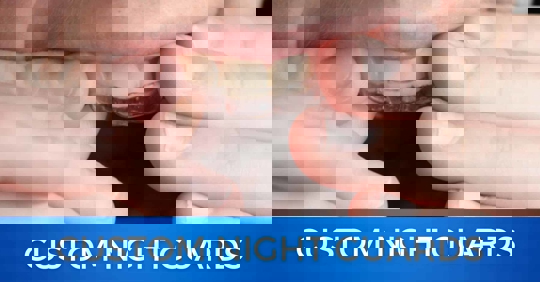 Your Secret Weapon Against Grinding: Custom Night Guards